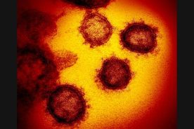 23f49e0a-6232-11ea-a446-1244d5f7c7c6-coronavirus